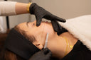 Discover the Best Facial Treatments in Vancouver for Glowing Skin
