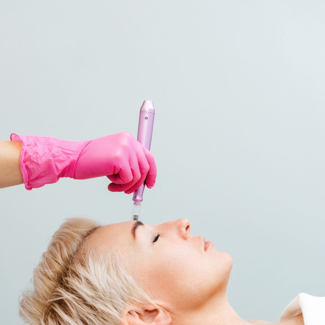Traditional Microneedling Package of 6