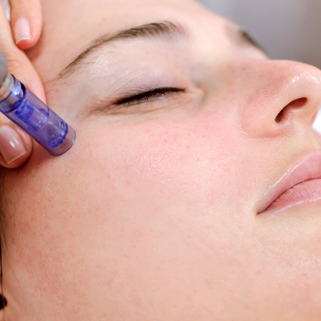 Growth Factor Nano-Needling Package of 6