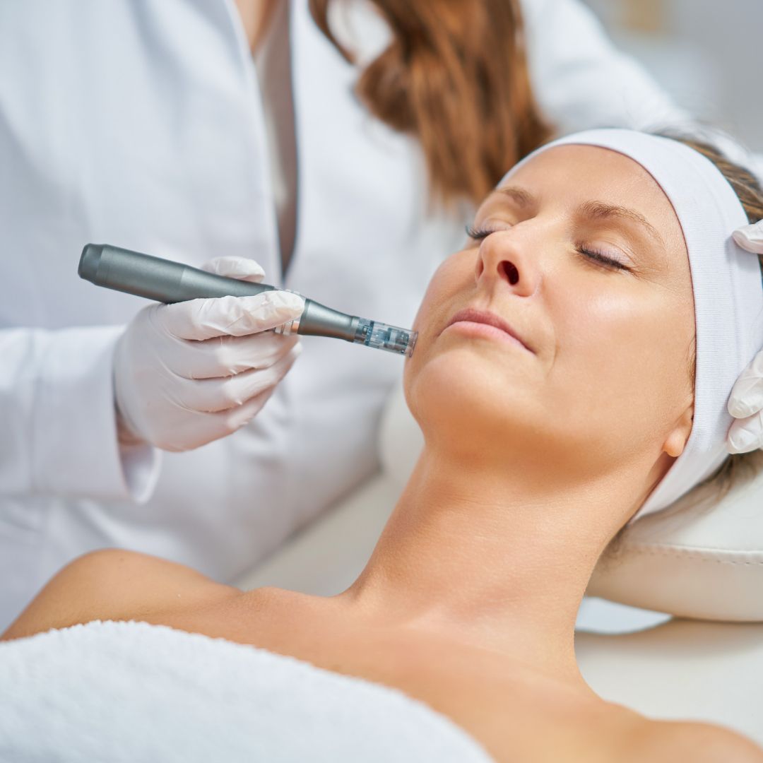 Traditional Microneedling Package of 6