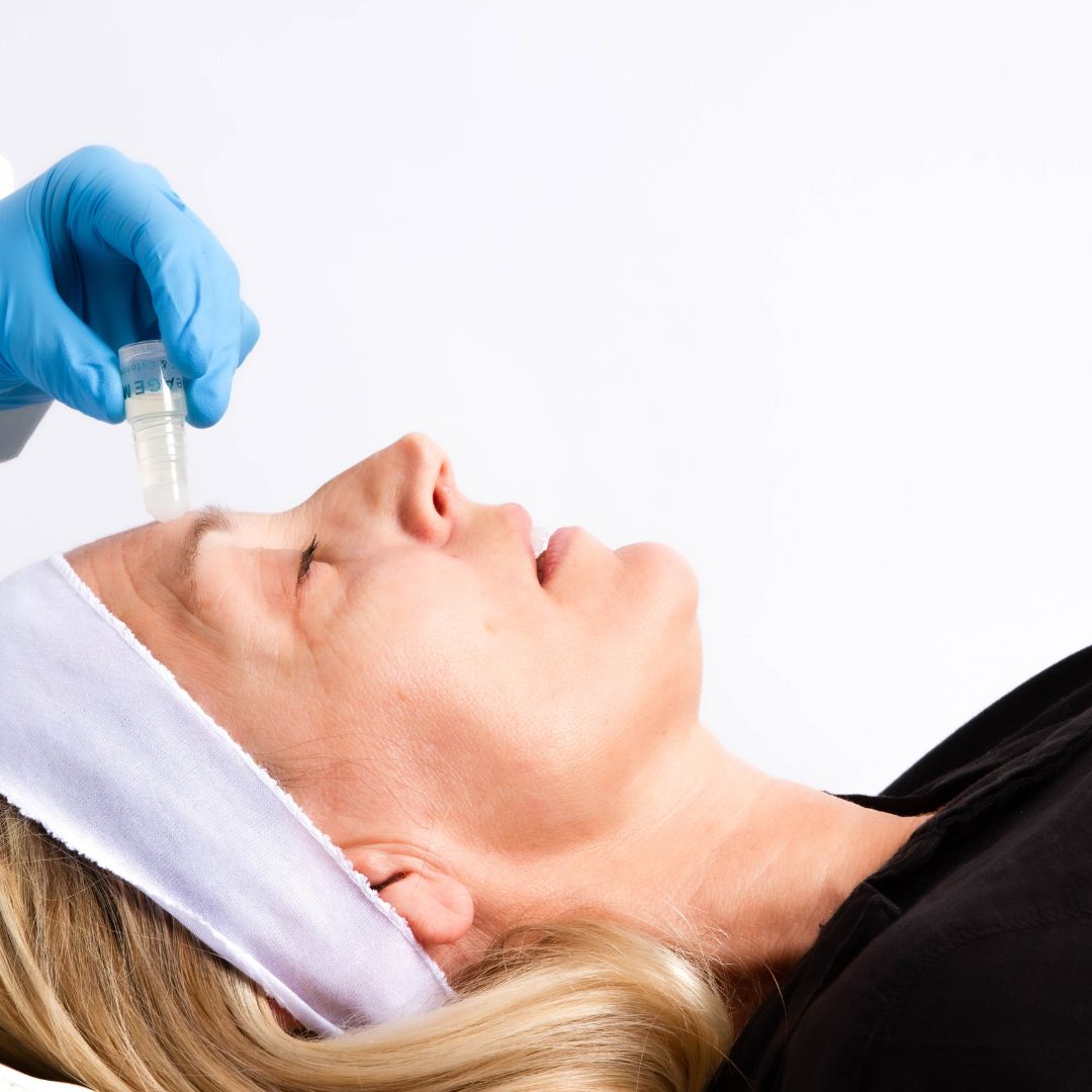 Growth Factor Nano-Needling Package of 6